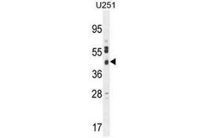 CB018 Antibody (C-term) western blot analysis in U251 cell line lysates (35µg/lane). (SLC35F6 抗体  (C-Term))