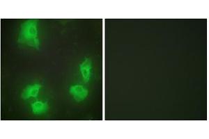 Immunofluorescence analysis of HeLa cells, using CDK5R1 antibody. (CDK5R1 抗体  (N-Term))
