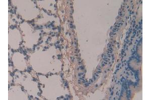 IHC-P analysis of Rat Lung Tissue, with DAB staining. (Periostin 抗体  (AA 659-810))