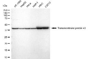 Western blotting analysis using transmembrane protein 43 antibody (ABIN7800622). (Recombinant TMEM43 抗体)