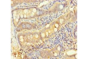 Immunohistochemistry of paraffin-embedded human small intestine tissue using ABIN7166174 at dilution of 1:100 (TESPA1 抗体  (AA 251-521))