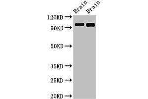 Western Blot Positive WB detected in: Rat brain tissue, Mouse brain tissue All lanes: ATP6V0A1 antibody at 3 μg/mL Secondary Goat polyclonal to rabbit IgG at 1/50000 dilution Predicted band size: 97, 96 kDa Observed band size: 97 kDa (ATP6VA1 (AA 80-260), (Isoform 1) 抗体)