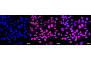 Immunocytochemical staining of HepG2 cells with Chromodomain helicase DNA binding protein 3 antibody (ABIN7798069), 1:1,000). (Recombinant CHD3 抗体)