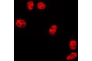 ABIN6275732 staining HepG2 by IF/ICC. (ZNF695 抗体  (C-Term))