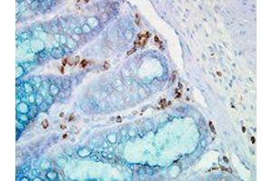 Hsp90 alpha Immunohistochemistry.
