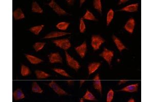 Immunofluorescence (IF) image for anti-Signal Transducing Adaptor Molecule (SH3 Domain and ITAM Motif) 2 (STAM2) antibody (ABIN7263017)