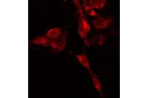 ABIN6275175 staining  HepG2 cells by IF/ICC. (GNAI3 抗体  (N-Term))