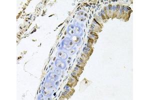 Immunohistochemistry of paraffin-embedded Mouse lung using ERBB4 Polyclonal Antibody at dilution of 1:100 (40x lens). (ERBB4 抗体)