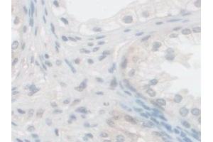 Immunohistochemistry (IHC) image for anti-Proprotein Convertase Subtilisin/kexin Type 1 (PCSK1) (AA 500-738) antibody (ABIN7435748)