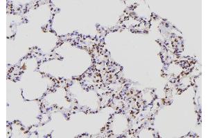 Immunohistochemistry (IHC) image for anti-Polymerase (RNA) II (DNA Directed) Polypeptide E, 25kDa (POLR2E) (Internal Region) antibody (ABIN6264345)