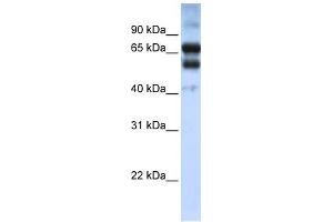 WB Suggested Anti-RARG Antibody Titration:  0. (Retinoic Acid Receptor gamma 抗体  (N-Term))