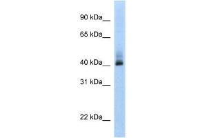 Human MCF-7; WB Suggested Anti-ANKRD42 Antibody Titration: 0. (ANKRD42 抗体  (N-Term))