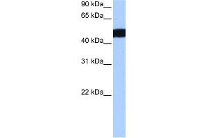 WB Suggested Anti-CROCCL2 Antibody Titration:  0. (CROCCP3 抗体  (N-Term))