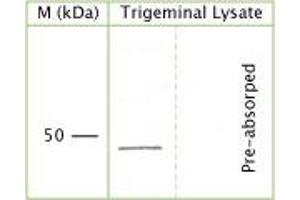 WB on rat trigeminal lysate (10% gel, 1:29. (NGFR 抗体  (Extracellular Domain))