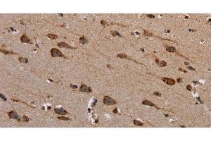 Immunohistochemistry of paraffin-embedded Human brain tissue using PLXNB1 Polyclonal Antibody at dilution 1:40 (PLXNB1 抗体)