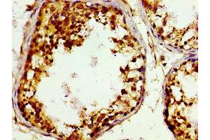 Immunohistochemistry of paraffin-embedded human testis tissue using ABIN7148935 at dilution of 1:100 (GAK 抗体  (AA 939-1086))