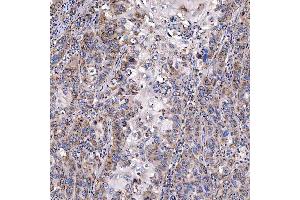 IHC analysis of TTC7B using anti-TTC7B antibody (ABIN7601050). (TTC7B 抗体  (AA 275-730))