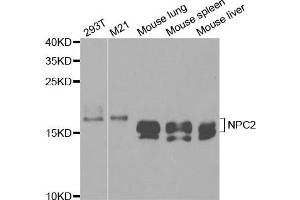 Western Blotting (WB) image for anti-Niemann-Pick Disease, Type C2 (NPC2) antibody (ABIN1876601) (NPC2 抗体)