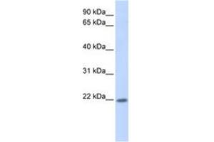 ZNF534 anticorps  (AA 101-150)