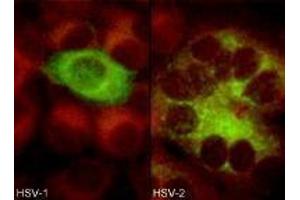 Immunofluorescence (IF) image for anti-Herpes Simplex Virus, Glycoprotein D (HSV gD) antibody (ABIN265572) (HSV gD 抗体)