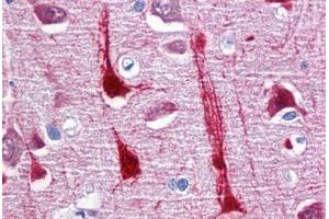 Human Brain, cortex: Formalin-Fixed, Paraffin-Embedded (FFPE) (CRYM 抗体  (AA 215-315))