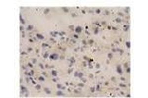 Image no. 1 for anti-Interleukin 18 (IL18) antibody (ABIN791564) (IL-18 抗体)