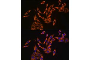 Immunofluorescence analysis of NIH/3T3 cells using UB Rabbit mAb (ABIN7271128) at dilution of 1:50 (40x lens).