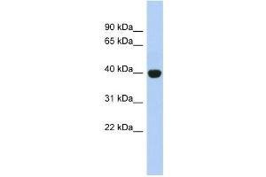 KIAA1191 antibody used at 1 ug/ml to detect target protein. (KIAA1191 抗体  (Middle Region))