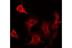 ABIN6275946 staining HeLa by IF/ICC. (FZD2 抗体  (Internal Region))