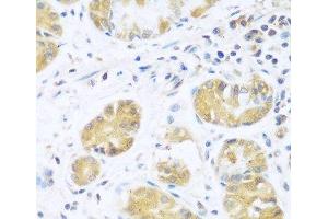 Immunohistochemistry of paraffin-embedded Human stomach using UCHL3 Polyclonal Antibody at dilution of 1:100 (40x lens). (UCHL3 抗体)