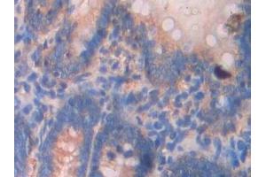 Immunohistochemistry (IHC) image for anti-Spectrin alpha Chain, Brain (SPTAN1) (AA 2071-2269) antibody (ABIN7438451)