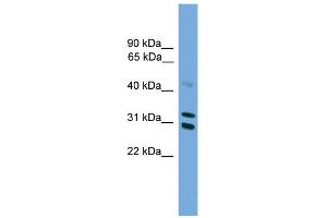 Western Blotting (WB) image for anti-Proteasome (Prosome, Macropain) Activator Subunit 2 (PA28 Beta) (PSME2) (Middle Region) antibody (ABIN2786731)