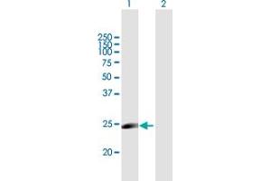 Western Blot analysis of MYLC2PL expression in transfected 293T cell line by MYLC2PL MaxPab polyclonal antibody. (MYL10 抗体  (AA 1-226))
