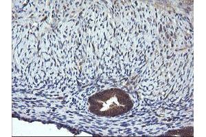 Image no. 4 for anti-Mitogen-Activated Protein Kinase Kinase 1 (MAP2K1) antibody (ABIN1499394) (MEK1 抗体)