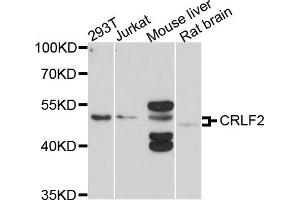 Western blot analysis of extracts of various cells, using CRLF2 antibody. (CRLF2 抗体)