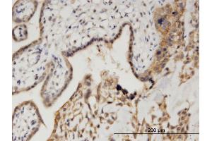 Immunoperoxidase of monoclonal antibody to CAMK1D on formalin-fixed paraffin-embedded human placenta. (CAMK1D 抗体  (AA 1-95))