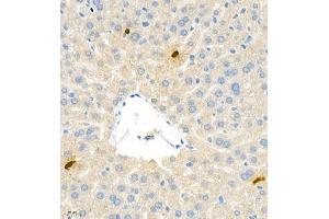 Immunohistochemistry (Paraffin-embedded Sections) (IHC (p)) image for anti-S100 Calcium Binding Protein A9 (S100A9) antibody (ABIN7075497)