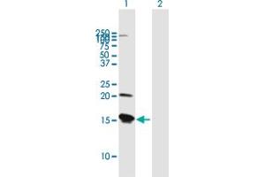 Western Blot analysis of VAMP8 expression in transfected 293T cell line by VAMP8 MaxPab polyclonal antibody. (VAMP8 抗体  (AA 1-100))