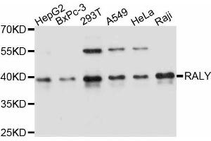 Western blot analysis of extracts of various cell lines, using RALY antibody. (Raly 抗体  (AA 96-306))