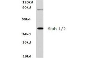 Western blot analysis of Siah-1/2 Antibody  in extracts from HeLa cells at 1/500 dilution. (SIAH1 抗体)