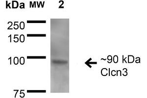 Western Blot analysis of Rat Brain Membrane showing detection of ~90 kDa CIcn3 protein using Mouse Anti-CIcn3 Monoclonal Antibody, Clone S258-5 . (CLCN3 抗体  (AA 98-115) (Atto 594))