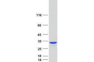 Western Blotting (WB) image for Triosephosphate Isomerase 1 (TPI1) protein (Myc-DYKDDDDK Tag) (ABIN2734309)