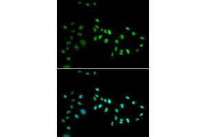 Immunofluorescence analysis of A549 cell using DNMT3A antibody. (DNMT3A 抗体)