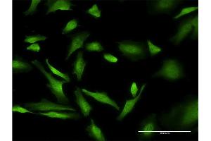 Immunofluorescence of monoclonal antibody to PURA on HeLa cell. (PURA 抗体  (AA 183-292))