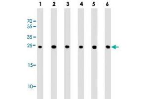 Western blot analysis of Lane 1: human liver lysates Lane 2: Hela whole cell lysates Lane 3: HepG2 whole cell lysates Lane 4: MCF-7 whole cell lysates Lane 5: Neuro-2a whole cell lysates Lane 6: PC-12 whole cell lysates reacted with PSMA5 monoclonal antibody  at 1:1000 dilution. (PSMA5 抗体)
