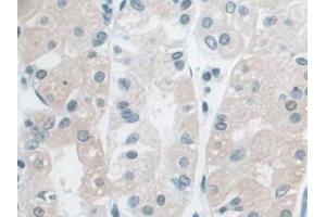 DAB staining on IHC-P; Samples: Human Stomach Tissue (Ancient Ubiquitous Protein 1 抗体  (AA 201-410))
