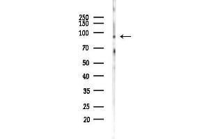 anti-Metastasis Associated in Colon Cancer 1 (MACC1) (N-Term) antibody