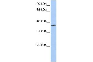 WB Suggested Anti-TMCC1 Antibody Titration:  0. (TMCC1 抗体  (C-Term))