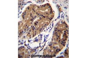 Immunohistochemistry (IHC) image for anti-Deleted in Colorectal Carcinoma (DCC) antibody (ABIN2996670) (DCC 抗体)