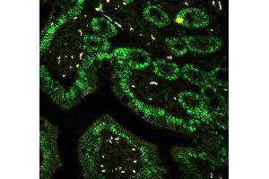 anti-C-terminal Binding Protein 2 (CTBP2) (AA 321-445) antibody